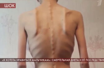 Пусть говорят 9.09.2020 – Смертельная диета и ее последствия