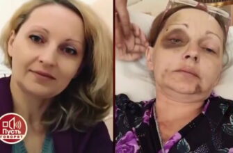 Пусть говорят 20.01.2021 – Муж избитой учительницы впервые раскрывает всю правду