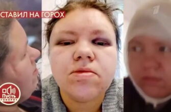 Пусть говорят 10.02.2021 – Племянница звезды в ужасе от мужа: "Он убьет меня!"